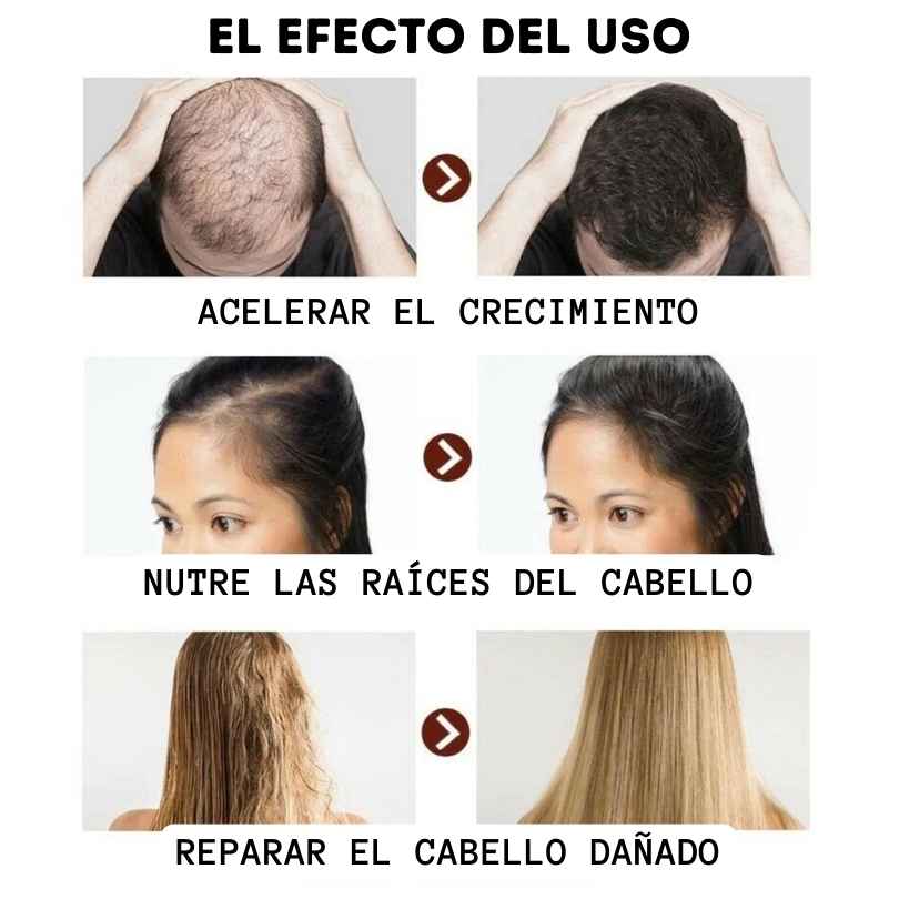 Serum 7 Days: Crecimiento acelerado (60ml)