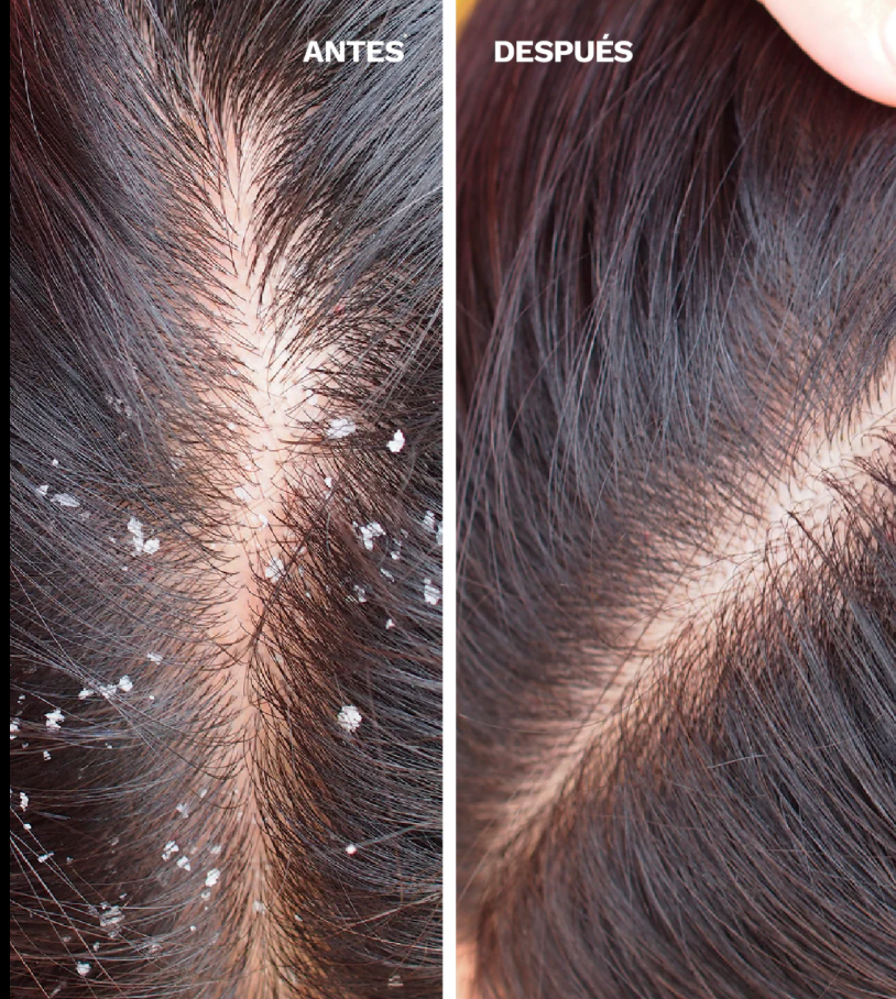 Nippori - Shampoo Anticaspa