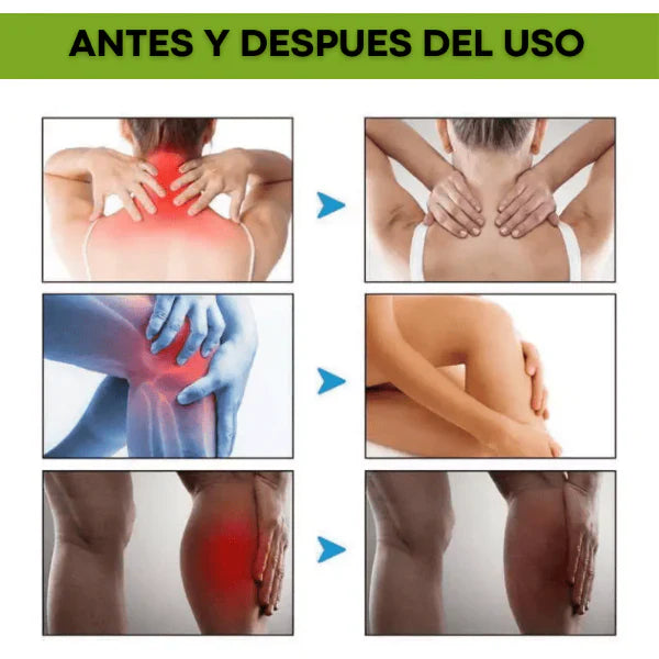 COMPRE BEEVANA - Crema De veneno de abeja Multifuncional + ENVIO GRATIS